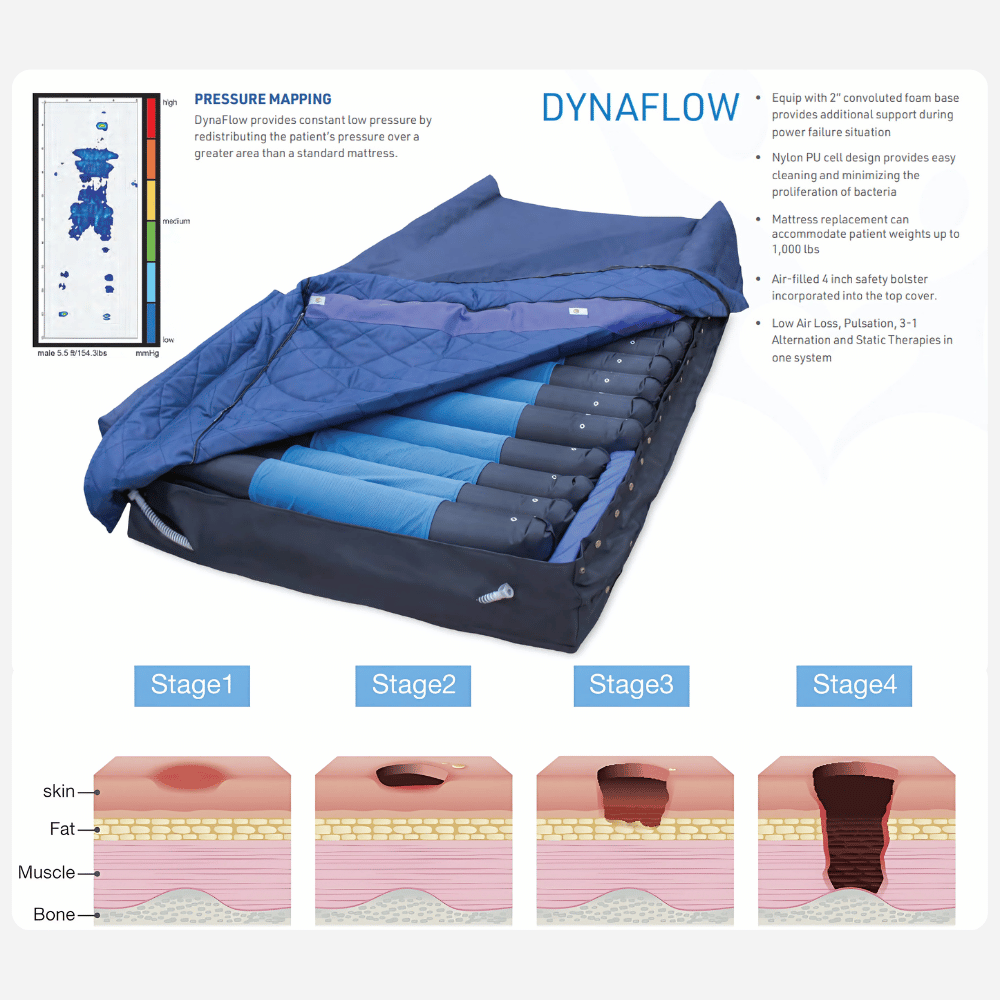Prius DynaFlow Low Air Loss Mattress System - NextGen HME